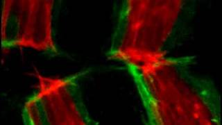 Dynamic cell matching during dorsal closure in live Drosophila embryos [upl. by Knowle116]