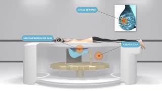 New Breast CT Scan Coming to Brookwood Baptist Medical Center [upl. by Inaliel14]