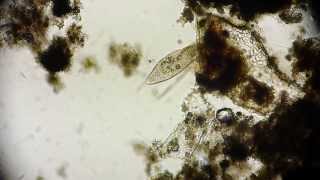 Pantoffeltierchen  Paramecium  Wimpertierchen  Ciliate  microorganisms under microscope [upl. by Ahsikyt]