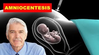 AMNIOCENTESIS MEDICAL DEFINITION OF AMNIOCENTESIS WHAT IS AMNIOCENTESIS [upl. by Sokil]