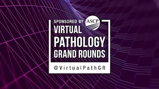 VPGR Renal Pathology Made Easy [upl. by Cocke980]