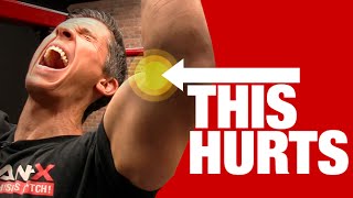 Elbow Pain with Pullups QUICK FIX [upl. by Heddie146]