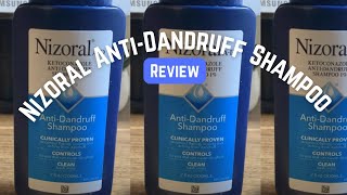 Nizoral AntiDandruff Shampoo Review [upl. by Edme]