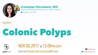 Colonic polyps  Dr Voltaggio Hopkins GIPATH [upl. by Erehs424]