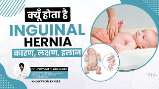 What is Inguinal Hernia Causes and Symptoms Treatment  बच्चों में अंडकोष हर्निया  लक्षण कारण [upl. by Eldoria527]