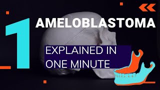 Ameloblastoma  Explained In One Minute AFK ACJ  INBDE ADC Written  OSCE [upl. by Emsmus237]