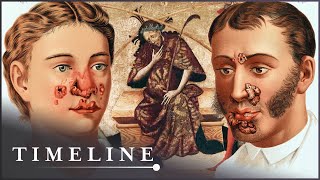 1495 Syphilis Outbreak The Deadly Disease That Swept Across Europe  The Syphilis Enigma  Timeline [upl. by Disini]