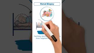 NCLEX Review Renal Biopsy position [upl. by Aig]