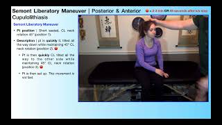 BPPV Treatment  Semont Liberatory Maneuver Why When amp How [upl. by Astri]