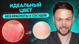 Как избавиться от покраснений и сосудов на лице Лучшие советы и процедуры от дерматолога [upl. by Sherj373]