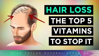 Top 5 Vitamins To PREVENT Hair Loss [upl. by Rolyt20]