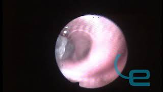 Endoscopic bronchoalveolar lavage in cat by means of catheter [upl. by Beauvais]