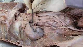 Anatomy Dissection of Kidney Relations Part 3 [upl. by End418]