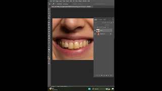 How To Whiten Teeth photoshop tutorial [upl. by Garcia]