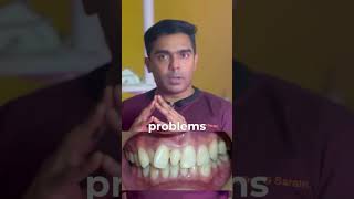 What Are Supernumerary Teeth Important Information for Patients [upl. by Garbe]