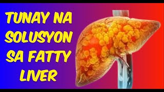 TUNAY NA SOLUSYON SA FATTY LIVER NAFLD [upl. by Griz]