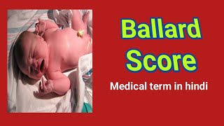 Ballard ScoreMedical term in hindi [upl. by Velleman]