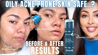 How Derma Co ABC Peptide Exfoliator Serum Works on Oily Acne Prone Skin Dr V Skin Renew Review [upl. by Nirot254]