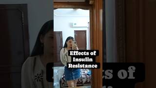 insulinresistance diabetesawareness insulinsensitivity healthtips girl shorts reels sugar [upl. by Fillian]