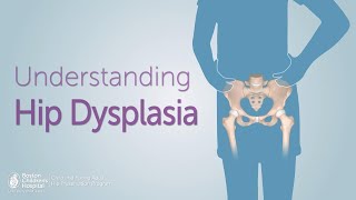 Understanding Hip Dysplasia  Boston Childrens Hospital [upl. by Nylarat]