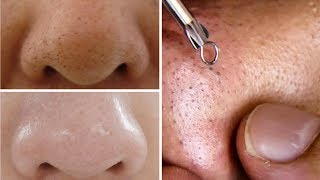 How To Do Facial Clean Up At Home Step By Step For Spotless Clear Skin Rabia Skincare [upl. by Elodie106]