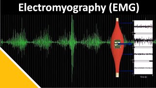 EMG Electromyography in Biomechanics  Delsys [upl. by Lucilia]