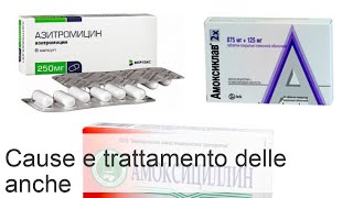 Gonfiore allanca cause sintomi e trattamento [upl. by Essined]