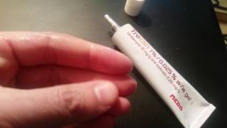 Acne medicine review  Treclin [upl. by Docila269]