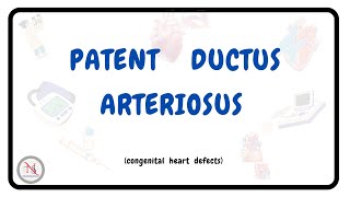 PATENT DUCTUS ARTERIOSUS  Causes  Symptoms  Pathophysiology  Treatment  The Nurses Station [upl. by Arahset]