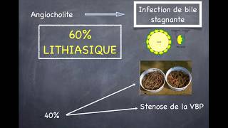 Lithiase Biliaire  4 Angiocholite [upl. by Ylicis]