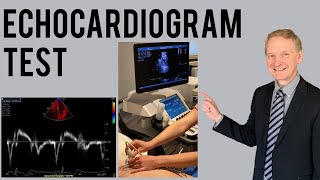 Echocardiogram Procedure  Heart Ultrasound  Everything you need to know [upl. by Anisor]