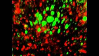 3D animation of clustered aVIntegrin in Caveolin1 marked osteosarcomas [upl. by Yajnas]