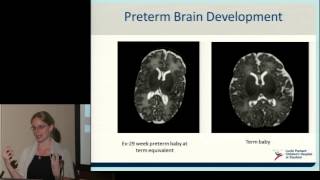 Neurodevelopment of Preterm Babies [upl. by Llemhar]