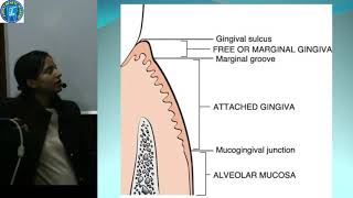 Periodontics 1 Normal Periodontium 1 Gingiva [upl. by Marcella]