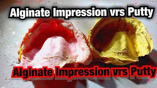 Alginate Impressions Vrs Putty [upl. by Ainat]