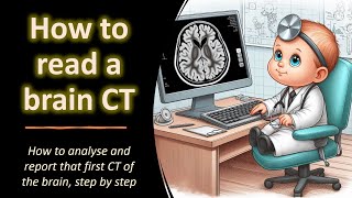 How to read a brain CT [upl. by Eenot423]