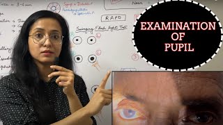 Examination Of Pupil  RAPD  Light Near Dissociation [upl. by Mattias3]