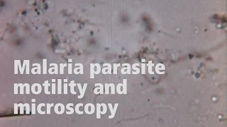 Jake Baum on the motility of malaria parasites [upl. by Brigitte]