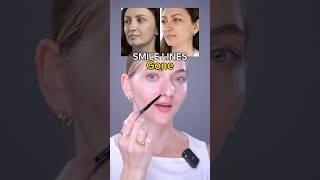 smile lines gone  Face Fitness  Facial Yoga  Face Massage  Face Work Out [upl. by Margery]