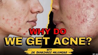 Clear amp Spotless Skin Tips  How to treat Pimples amp Acne [upl. by Bromley]