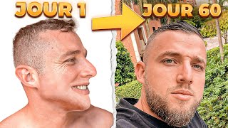 COMMENT JAI EU MA BARBE EN 8 SEMAINES minoxidil barbe [upl. by Jedthus]