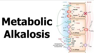 Metabolic Alkalosis [upl. by Hieronymus]