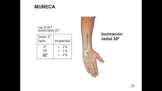 GONIOMETRIA VALORES POR LIMITACIONES LEY 2457 1 [upl. by Eidassac666]