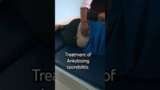 Chiropractic Treatment of severe ankylosing spondylitis Young Spine Clinic Haldwani [upl. by Lamok]