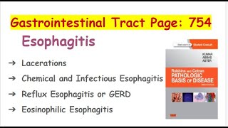 Esophagus Lecture 2 ESOPHAGITIS AND GERDROBBINS AND COTRAN [upl. by Erasmus90]