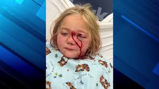 MI Boy saves 6 year old sister from dog attack [upl. by Cristen]