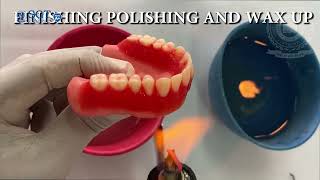 Posterior teeth arrangement  E Learning  SGT University [upl. by Hairabez299]