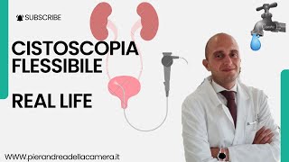 REAL LIFE CISTOSCOPIA FLESSIBILE [upl. by Adar52]