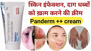 Panderm cream  Panderm cream Panderm cream use in Hindi  pendram cream ke fayde  shorts [upl. by Makell]