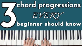 Common Chord Progressions Every Beginner Should Know [upl. by Ydnak]